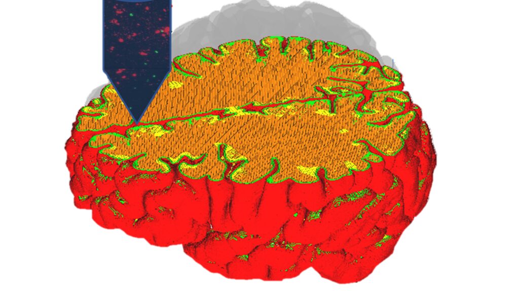 Rappresentazione schematica dell'obiettivo del progetto: realizzare un modello tridimensionale di corteccia cerebrale mediante biostampa 3D di cellule derivate da organoidi corticali