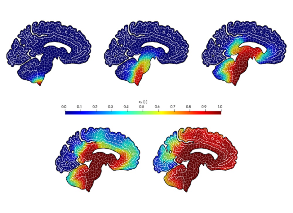 Mesh poligonale di una sezione di cervello nel piano sagittale e simulazione della concentrazione di proteina alfa-sinucleina nella malattia di Parkinson in un arco temporale di venti anni. Lavoro in collaborazione con Mattia Corti e Francesca Bonizzoni.