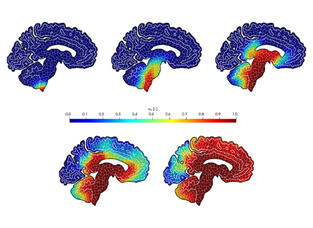 Polygonal mesh of a brain section in the sagittal plane and simulation of the concentration of alpha-synuclein protein in Parkinson's disease over a period of twenty years. I work in collaboration with Mattia Corti and Francesca Bonizzoni.